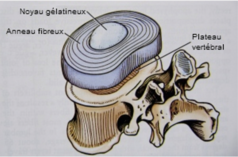 Canal Cervical Troit Chirurgie Orthop Dique